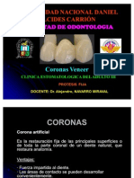 Coronas Veneer