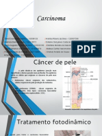 Carcinoma