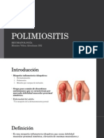 POLIMIOSITIS