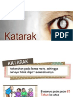 Flipchart Katarak