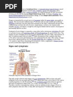 Signs and Symptoms: Dengue Fever, Also Known As Breakbone Fever, Is A