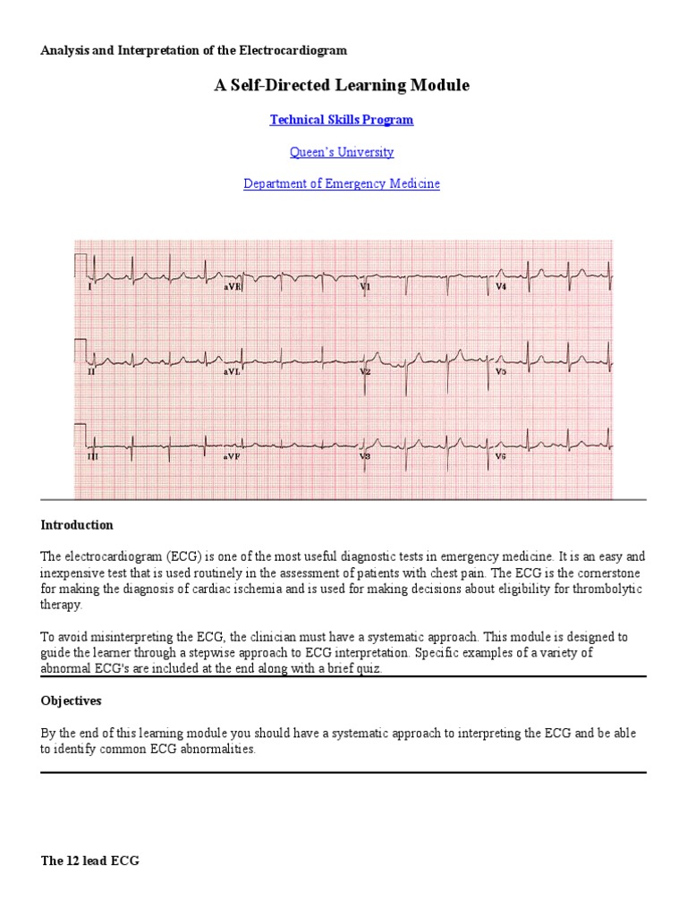 Systematic ECG Interpretation Guide | PDF | Science & Mathematics
