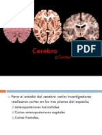 Diapositiva - Cortes Del Cerebro