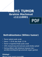 Tumor Wilms