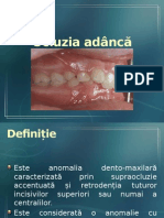 Ocluzia Adanca Acoperita