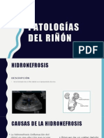 patologias del rinon