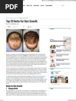 8 Herbs And Oils That Promote Hair Growth Hair Loss Vitamin