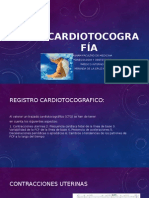 Cardiotocografía