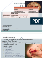 Tonsilitis Membranosa