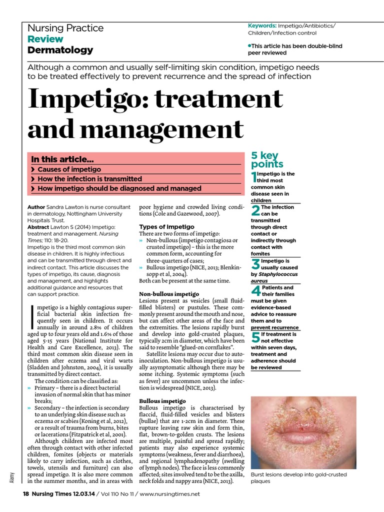 Impetigo Treatment and Management PDF Methicillin Resistant Staphylococcus Aureus Infection