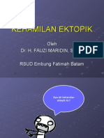 Kehamilan Ektopik