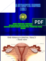 Neoplasia Intraepitelial Serviks