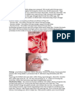 Sinusitis Akut Sinusitis Adalah Radang Sinus Paranasal