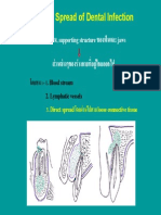 Routes - Spread of Oral Infections