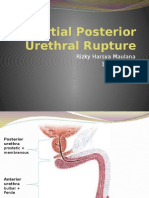 Partial Urethral Rupture