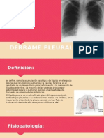 Derrame Pleural