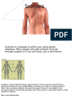 Scoliosis