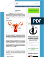 Pengobatan Polip Endometrium – OBAT HERBAL POLIP