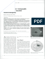 Acta Ophthalmol Scand 2000 Feigl-1