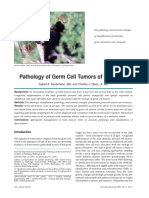 Pathology of Germ Cell Tumors of The Testis