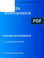  Extracţia Alveoloplastica 