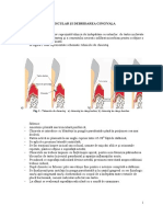 Chiuretaj Radicular