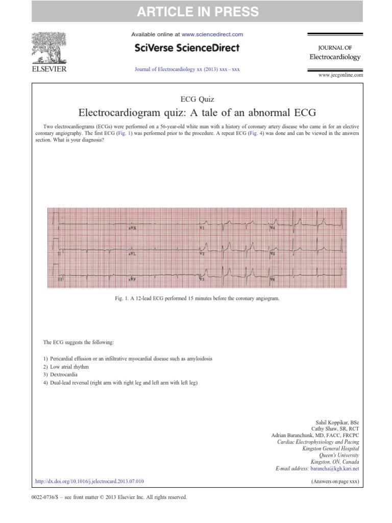 ECG Quiz | Electrocardiography | Organ (Anatomy)