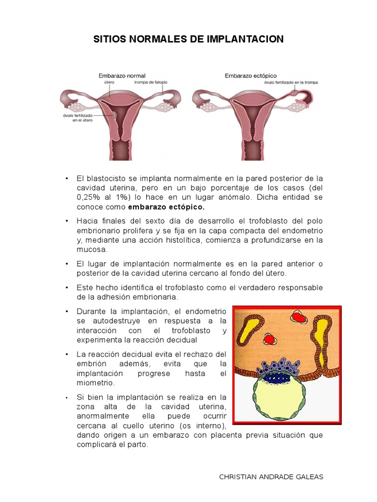 Sitios Normales de Implantacion | PDF