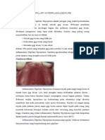 Inflammatory Papillary Hyperplasia