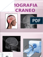 Craneo TAC