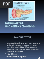 PANCREATITIS