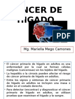 Cáncer de Higado