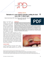 Fabrication of a Screw Retained Restoration Avoiding the Facial Access Hole a Clinical Report 2015 the Journal of Prosthetic Dentistry