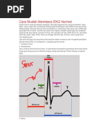 Download CaraMudahMembacaEKGNormalbyFherySN294000841 doc pdf