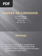 Causes of Cirrhosis: by Asad Samejo Final Year MBBS Group A6 Roll. No 185