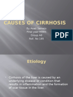 Causes of Cirrhosis: by Asad Samejo Final Year MBBS Group A6 Roll. No 185