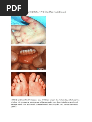 Flu Singapura Pdf