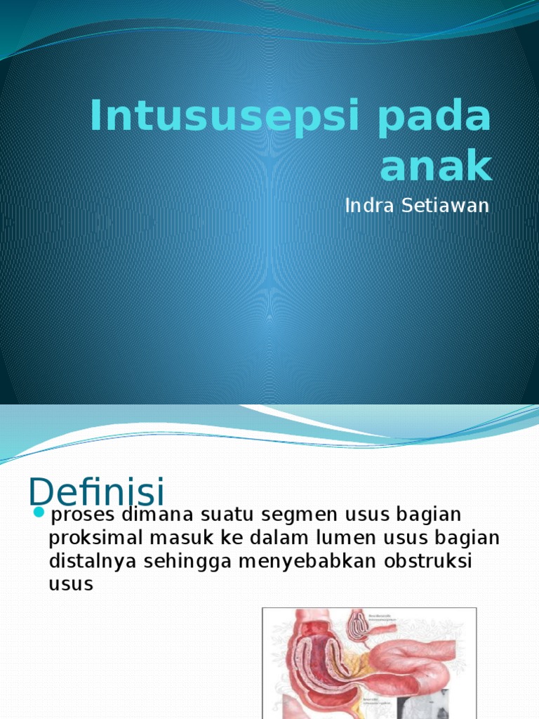 Intususepsi pada Anak: Diagnosis dan Penanganan | PDF | Pengembangan Diri