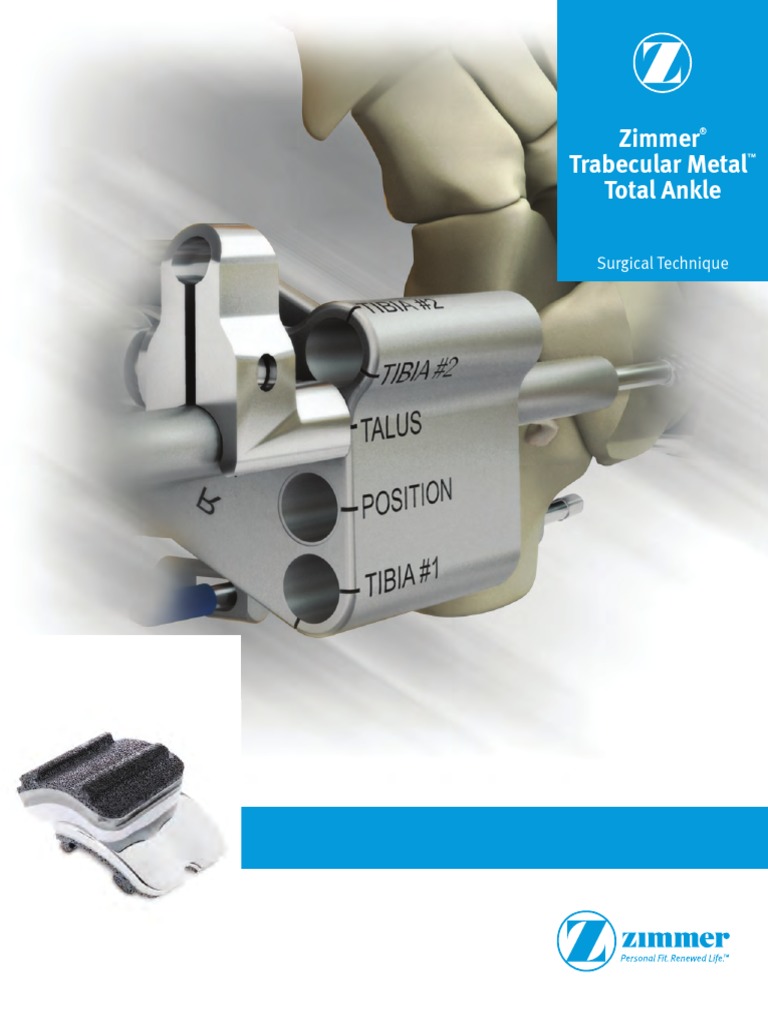 Zimmer Trabecular Metal Total Ankle Surgical Technique | PDF | Ankle | Foot