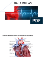 Atrial Fibrilasi