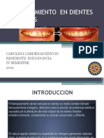 Blanqueamiento Dental en Dientes No Vitales