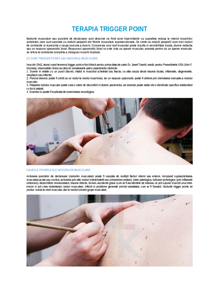 Terapia Trigger Point | PDF