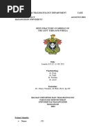Download Case Report Fracture Tibia Fibula by Muhammad Nuralim Mallapasi SN294623379 doc pdf
