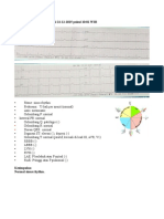 Tugas Baca Ekg Minggu 3