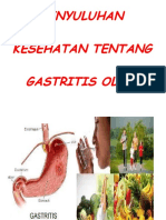 Bahaya Gastritis