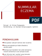 Nummular Eczema