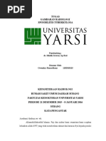 Download Tugas Gambaran Radiologi Spondilitis Tuberkulosa by Gwendry Ramadhany SN294700027 doc pdf