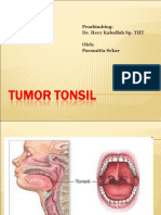 Tumor Tonsil