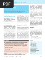 Basal Cell Carcinoma Rebecca Cc Brooke