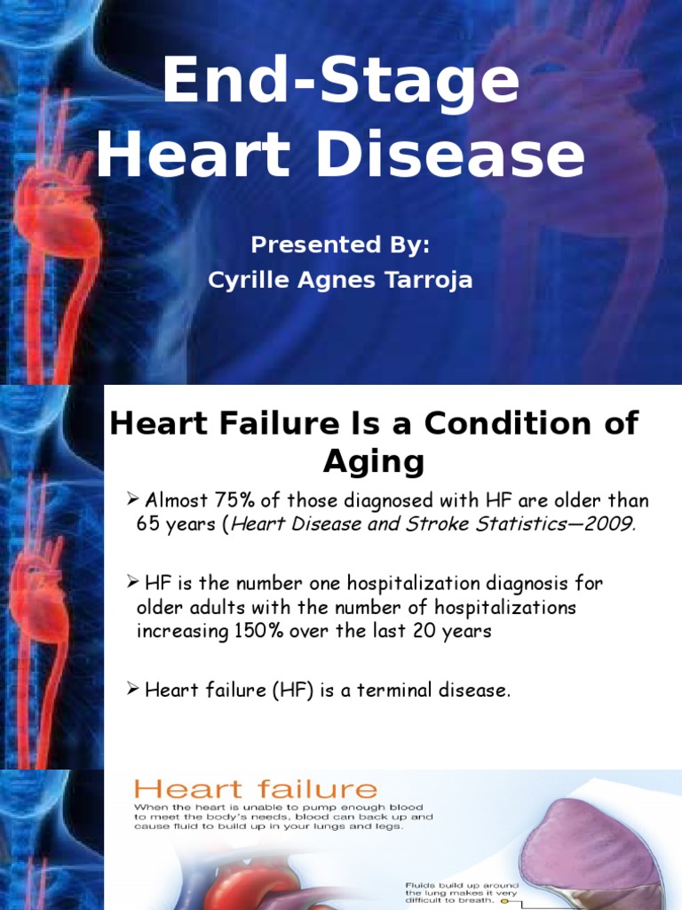 End-Stage Heart Disease | Heart Failure | Palliative Care